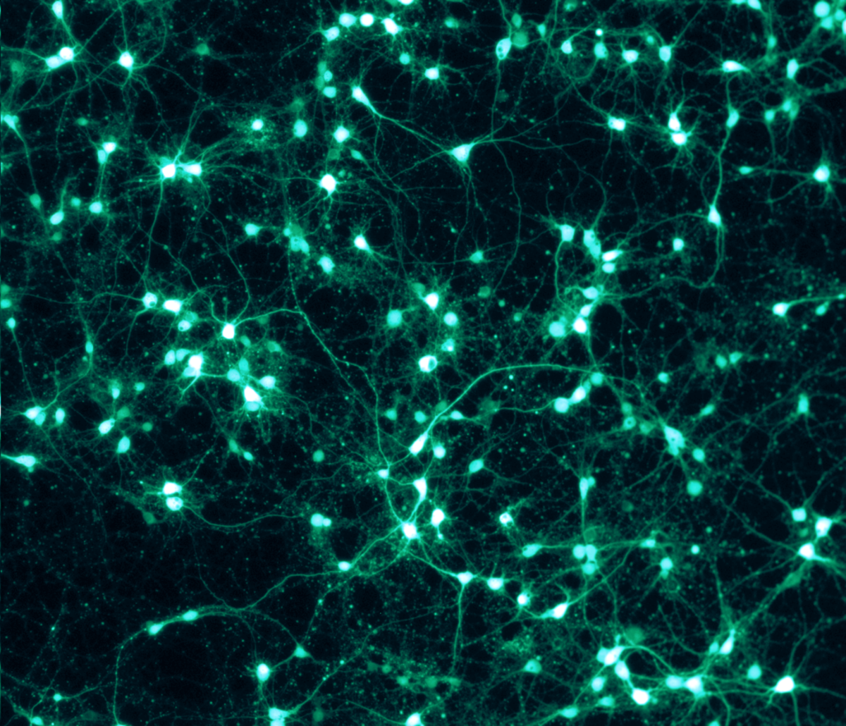 What Is the Structure and Layout of Neurons in the Brain?