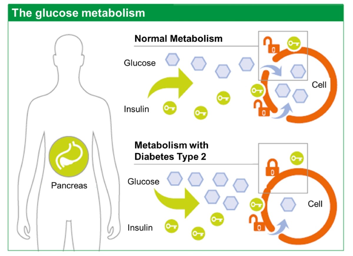 Diabetes What Does It Mean   HubPages