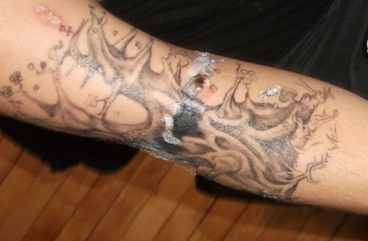Would a Tattoo Artist Be Able to Lighten a Dark Tattoo Part 1  Certified  Tattoo Studios