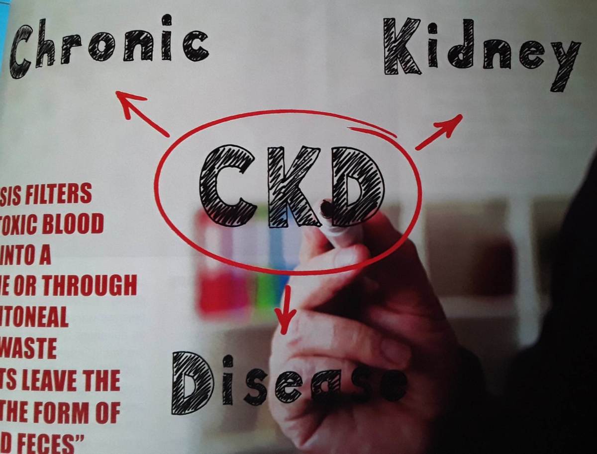Kidney Disease Can Kill You by Surprise