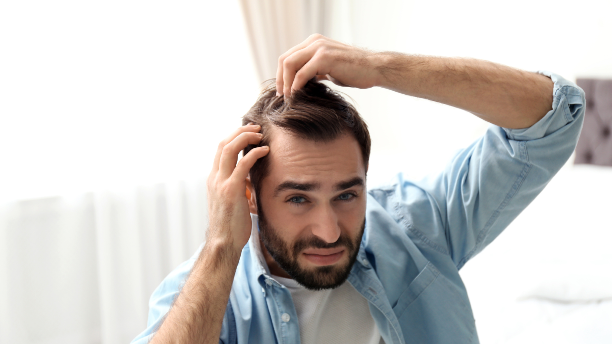 9 Ways to Cover Up Hair Loss if Nothing Else Works
