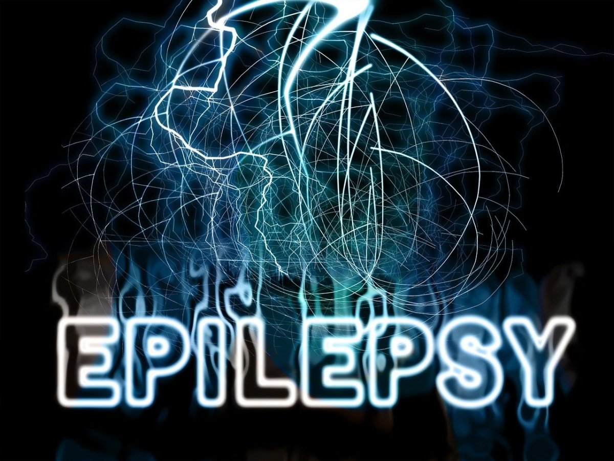 Primary Information About Epilepsy Treatments and Management