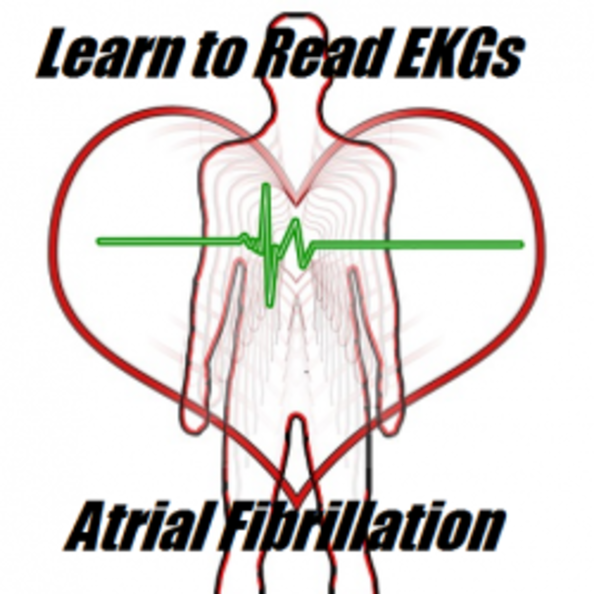 How to Read EKGs: Identifying Atrial Fibrillation