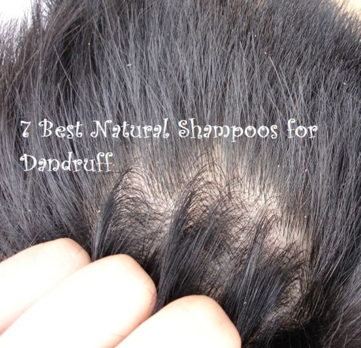 7 Best Natural Shampoos for Dandruff