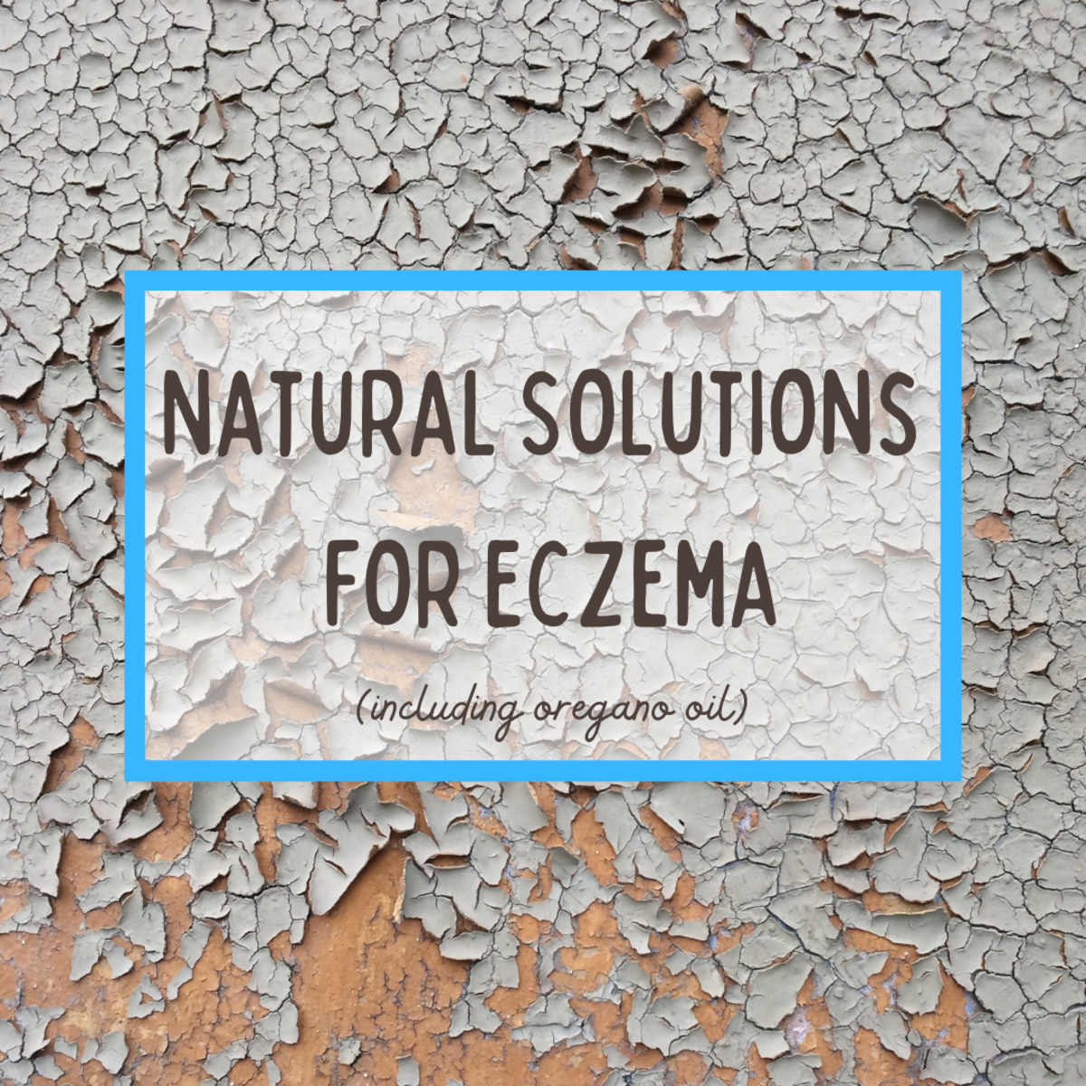 Can you solve eczema with items at home?