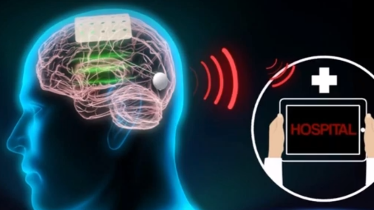 wireless-brain-sensor