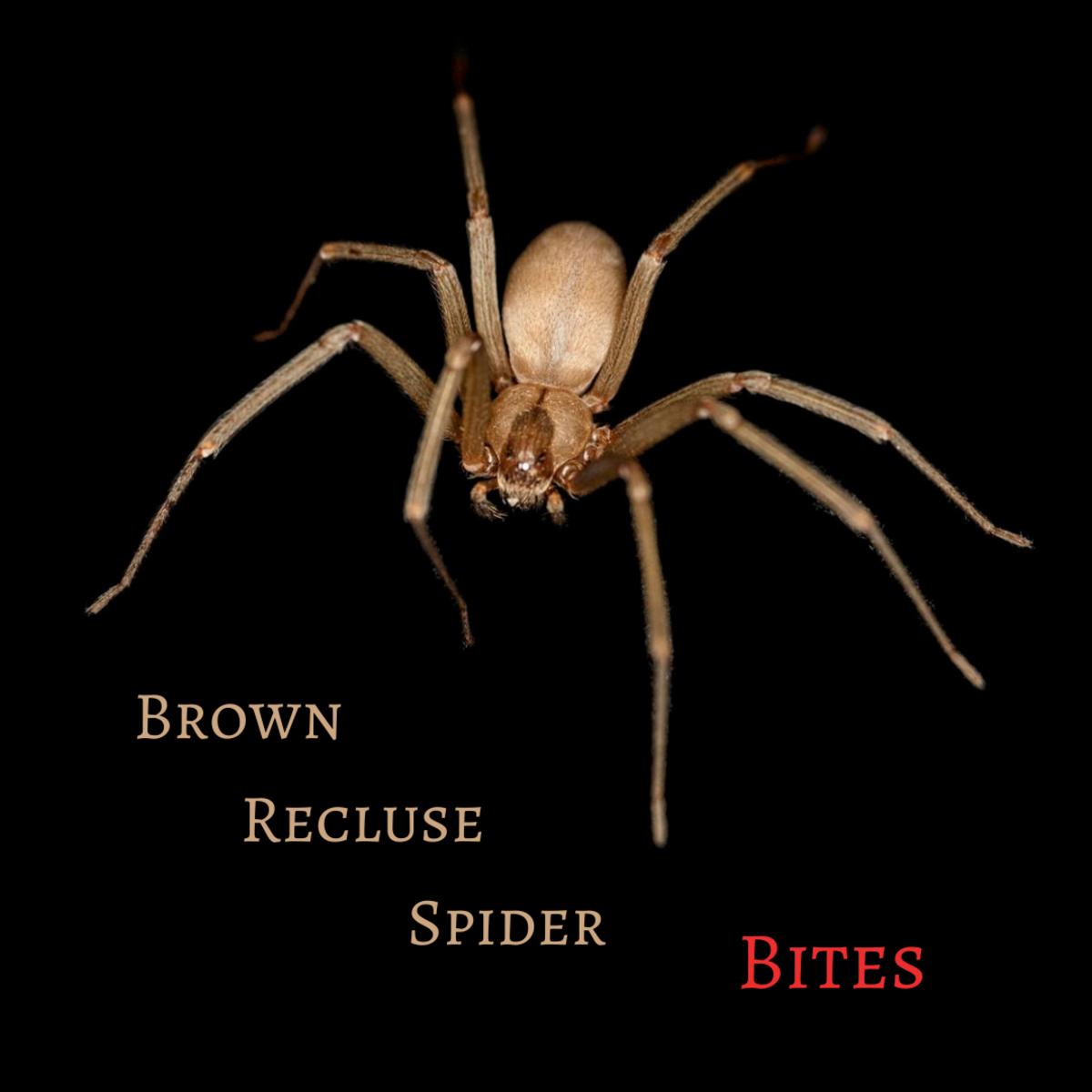 Brown Recluse Bite: Pictures, Stages, Symptoms & Treatment