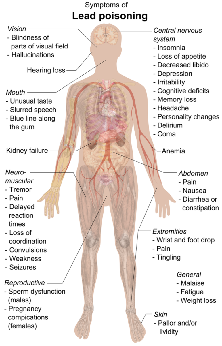 Lead poisoning's side effects. It can be fatal.
