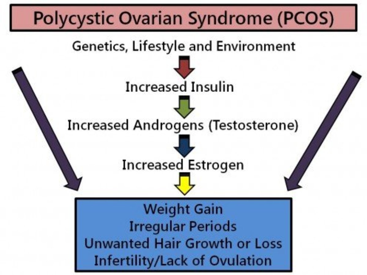 How to Cure Your PCOS-- Polycystic Ovary Syndrome
