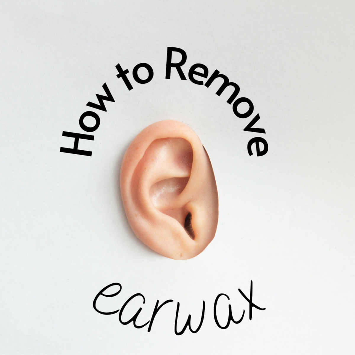 A Correct Way to Remove Impacted Earwax That Worked for Me RemedyGrove