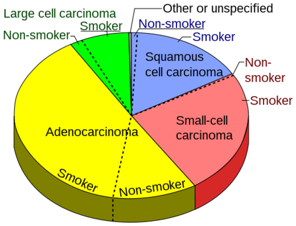 Pie chart showing incidences of NSCLCs as compared to SCLCs shown at right, with fractions of smokers versus nonsmokers shown for each type, Wikipedia.com