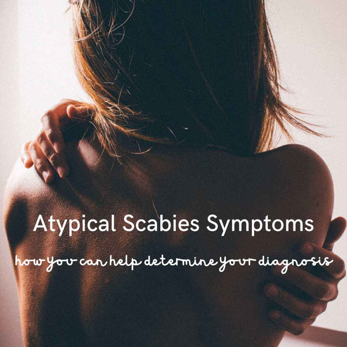 Are your scabies symptoms abnormal? Hopefully my story can help.