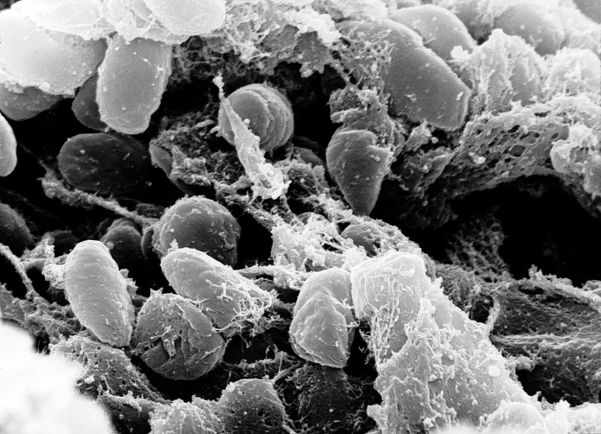 Yersinia Pestis (pictured) caused the bubonic plague and the black death.