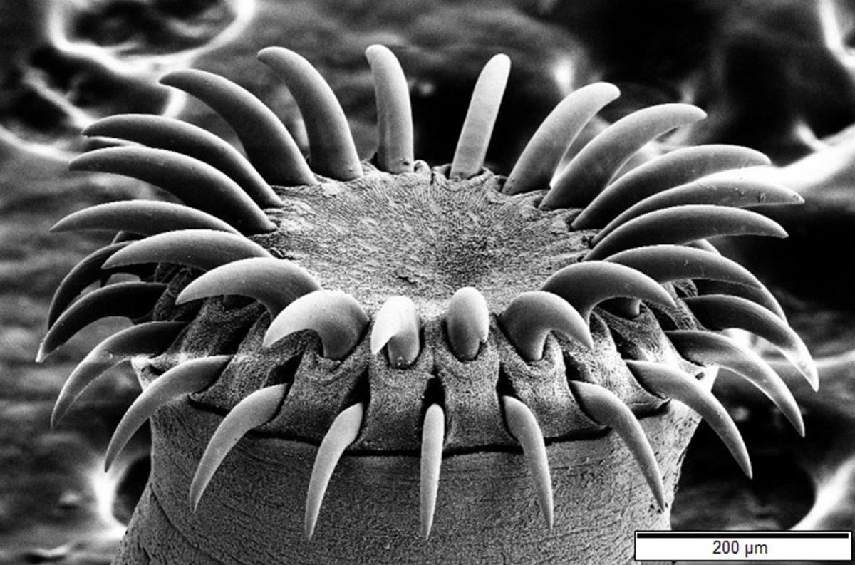The hooks of a tapeworm's scolex (head) up close.
