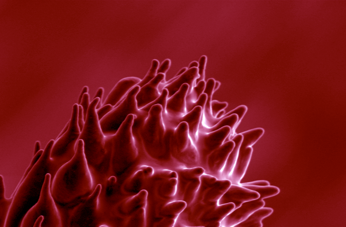Colorized electron microscopy (SEM) image of a dandelion stamen.