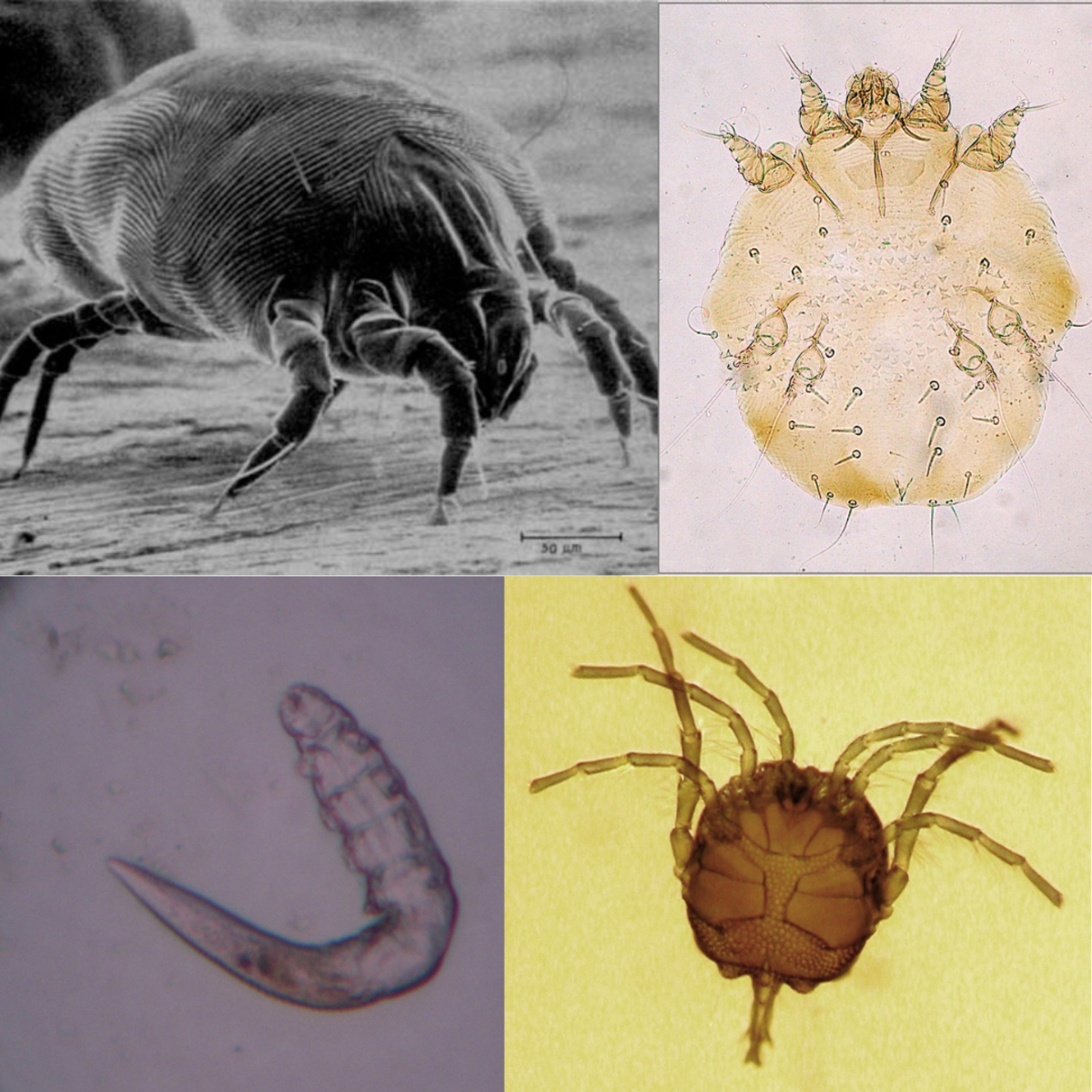 Clockwise from top left corner: dust mite, parasitic mite, water mite, face mite.