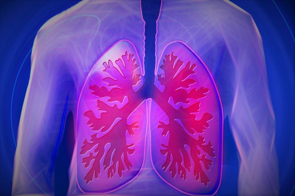 The Return of Tuberculosis - Cases Rise in North West England