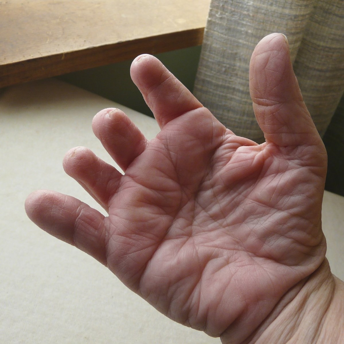 Palm of sym hand showing tiny fingernails