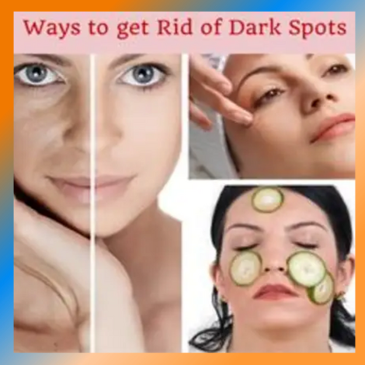 How To Get Rid Of Dark Spots On Your Face HubPages