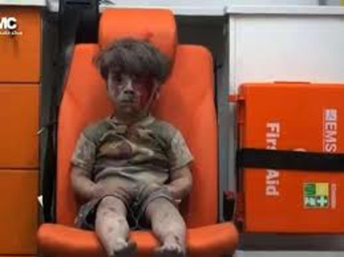 What the Media is Missing in the Bloody Boy from Aleppo Photo: Thank You, Hillary