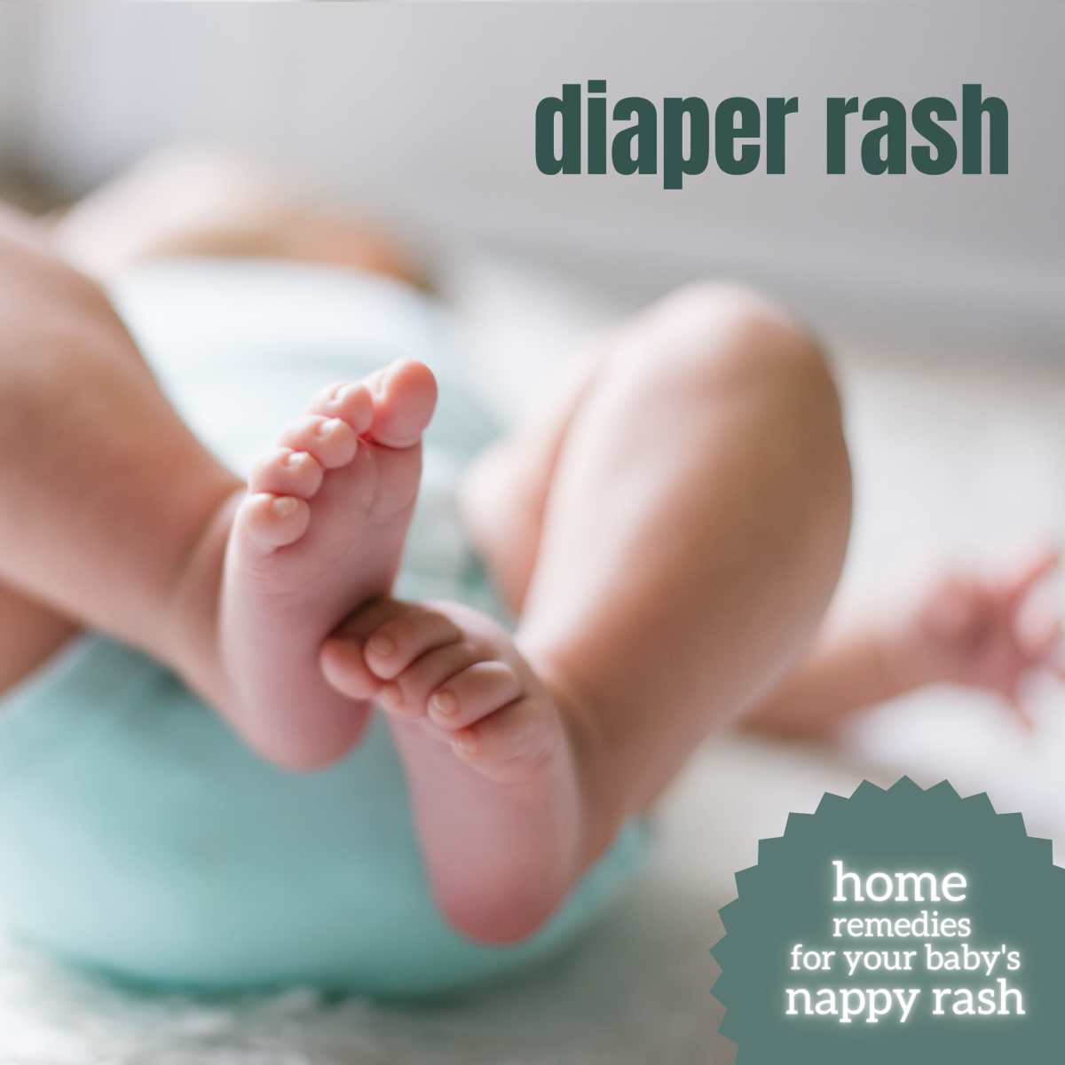 Home Remedies for Diaper Rash (Nappy Rash)