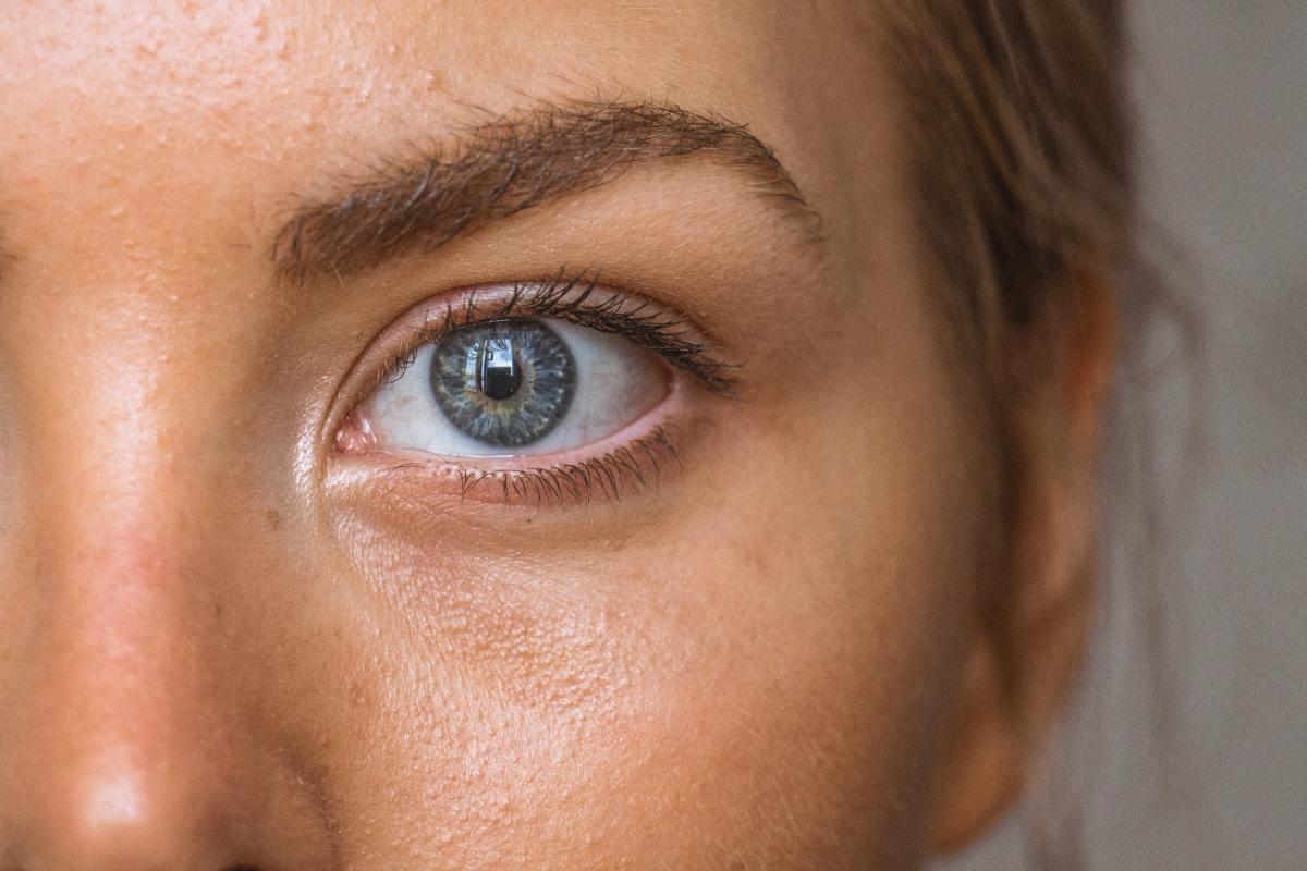 Try these methods to see if they help eliminate dry skin surrounding your eyes.  