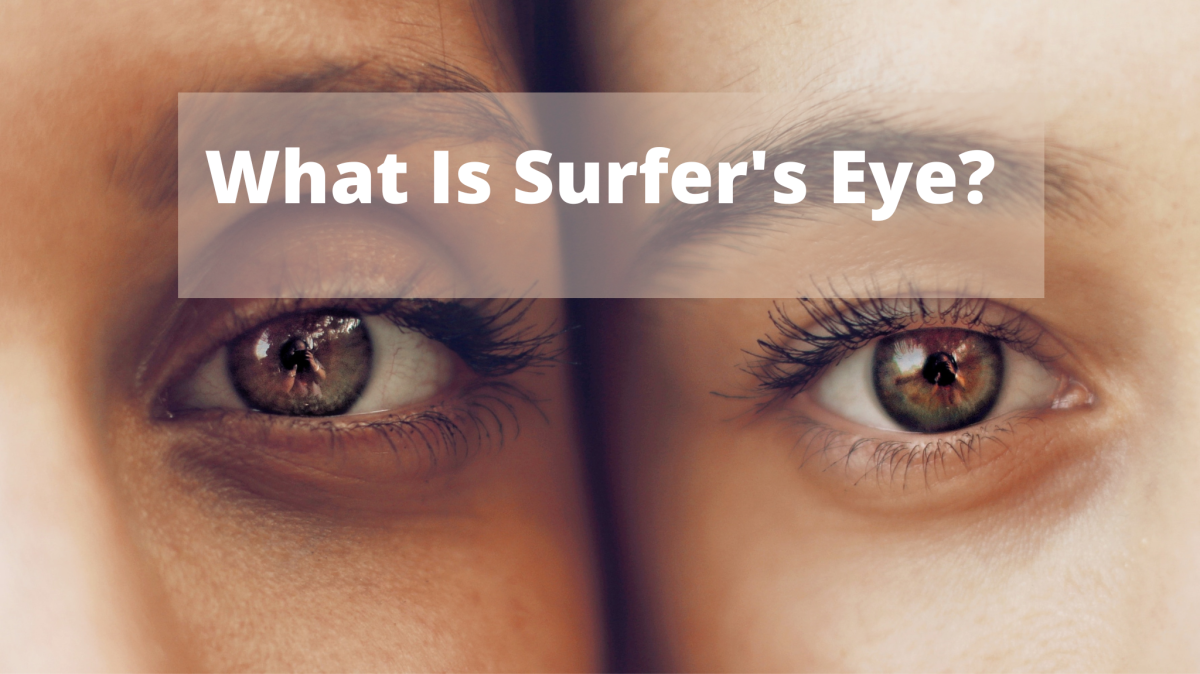 What Is Surfer's Eye? Pterygium and Pinguecula Explained