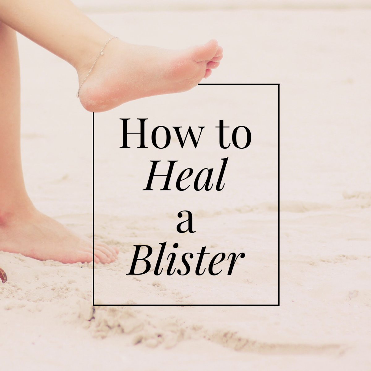 Blisters: Causes and Treatment