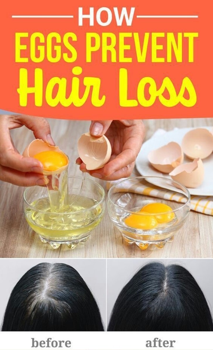 How Eggs Prevent Hair Loss - HubPages
