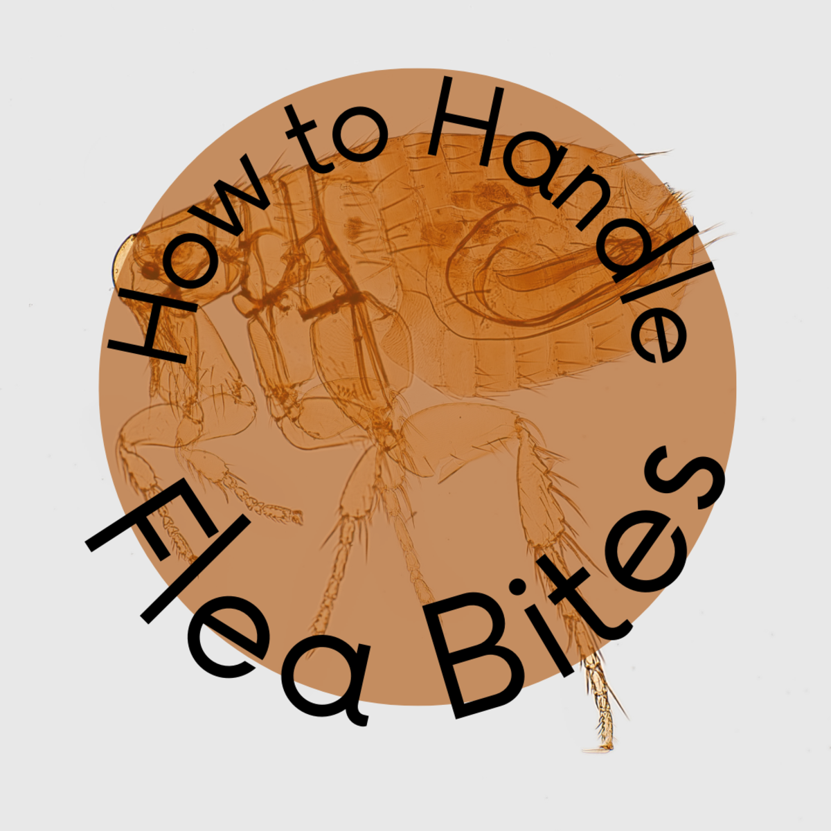 How to Handle Flea Bites