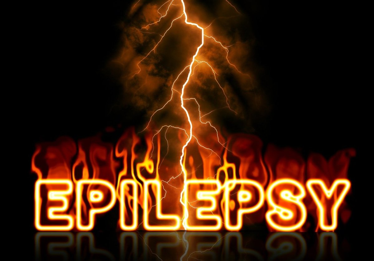 Epilepsy Symptoms, Diagnosis and Treatments
