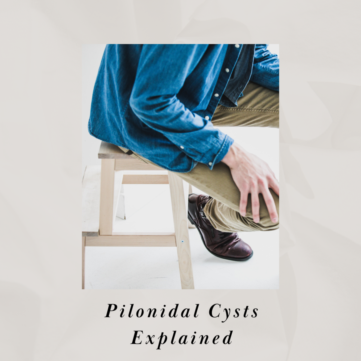 Pilonidal cysts appear most commonly on the tailbone area at the top or near the top of the cleft of the buttocks. Most doctors believe that it is caused by an ingrown hair that then becomes infected.