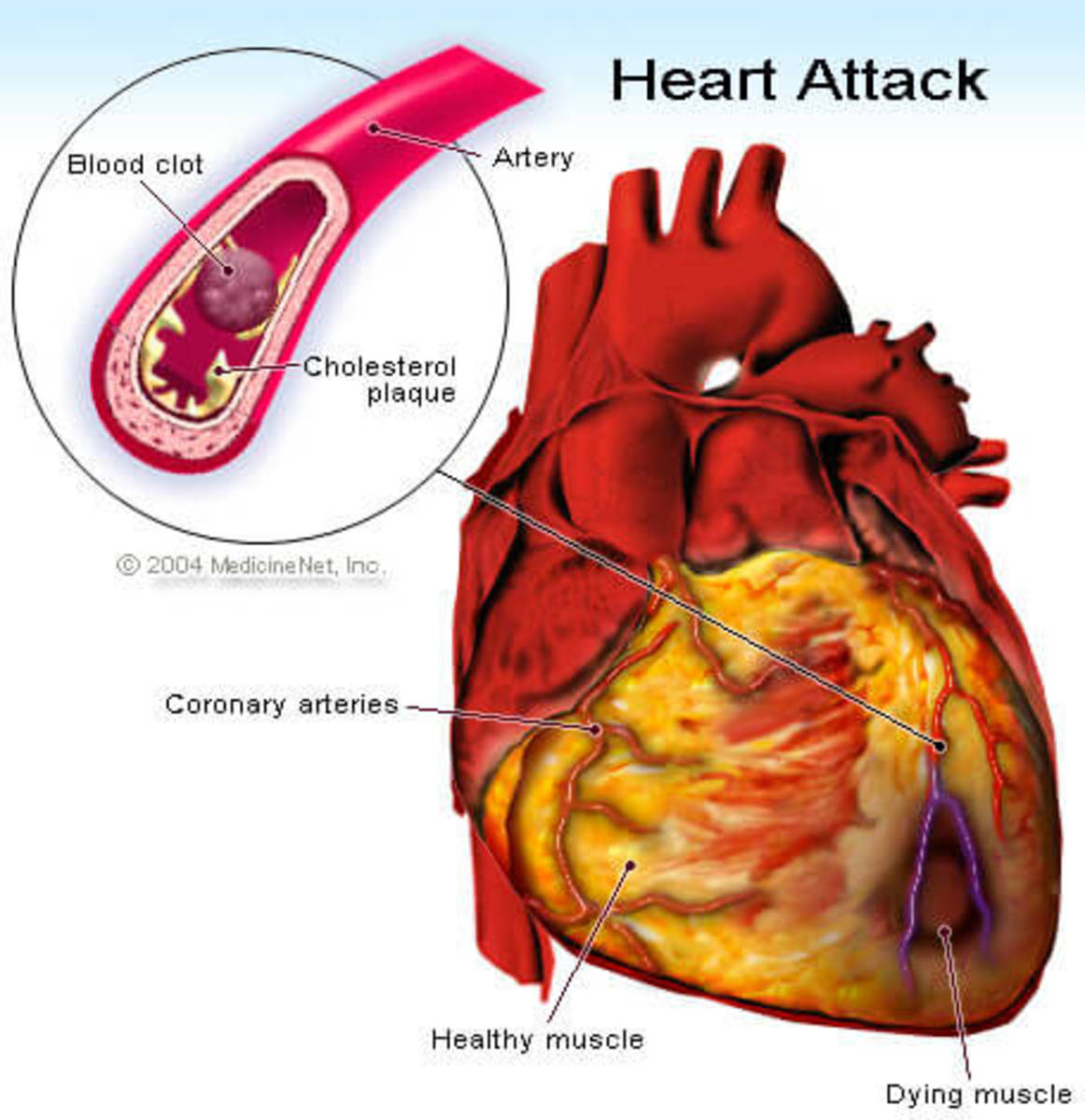 Signs and Symptoms: How You Can Know if You are Having a Heart Attack!