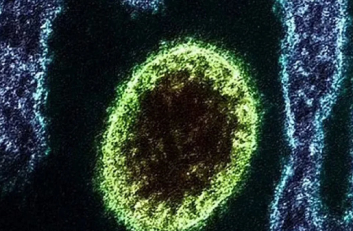 A New Virus Scare in China, Infected 35