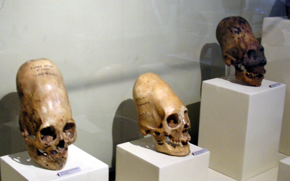 The mysterious skulls discovered in Paracas.