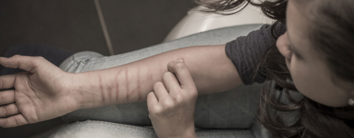 How to Support a Teenager Who Self-Harms