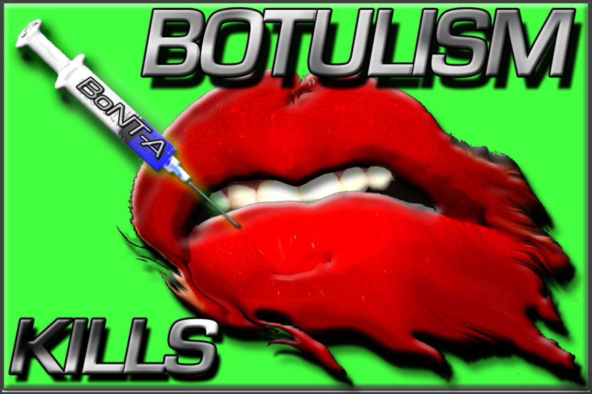 Big Red Botox Lips, Botulism Kills - (BoNT-A) 