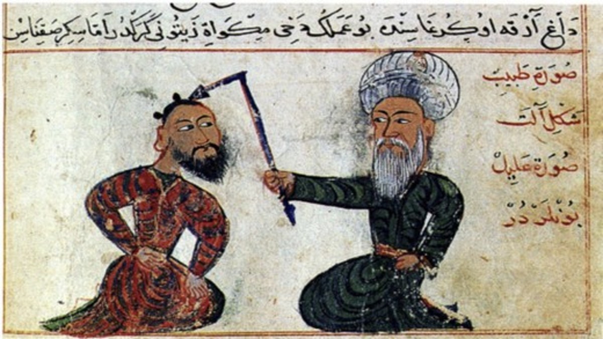 “Epilepsy treatment from the surgical atlas Cerrahiyetül Haniye (Imperial surgery). Drawn in the 15th century (1465). Collection: Ataturk Institute for Modern Turkish History, Istanbul, Turkey