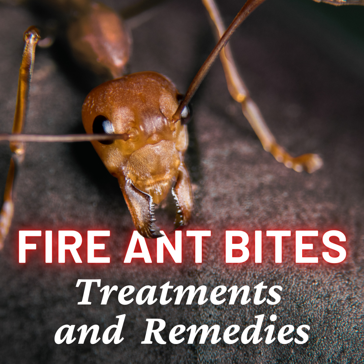 Home remedies for fire ant bites 