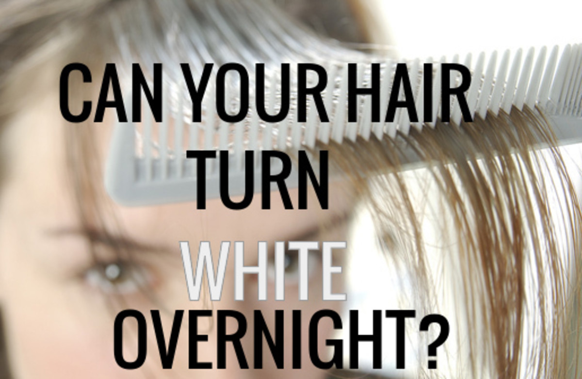 Hair turn white overnight