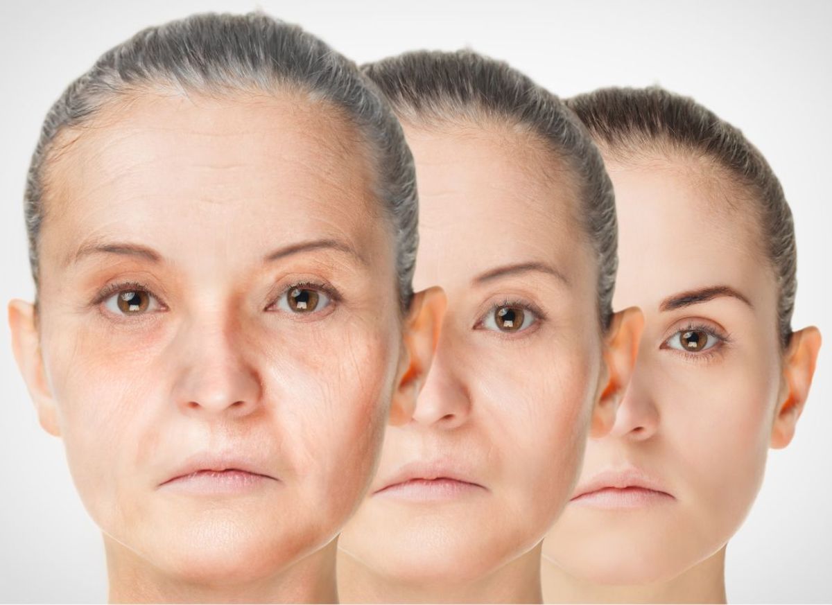 The Harmful Effects of Smoking on Skin Aging