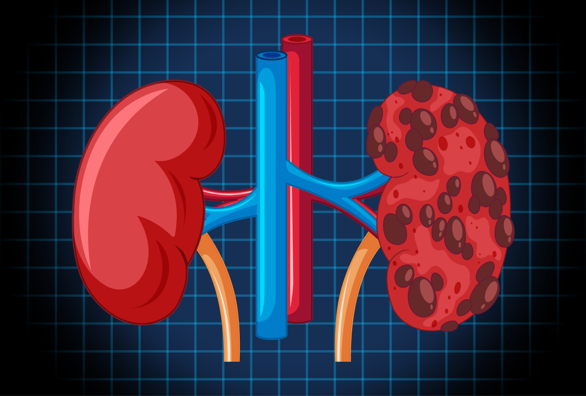 How do you know your kidneys are healthy