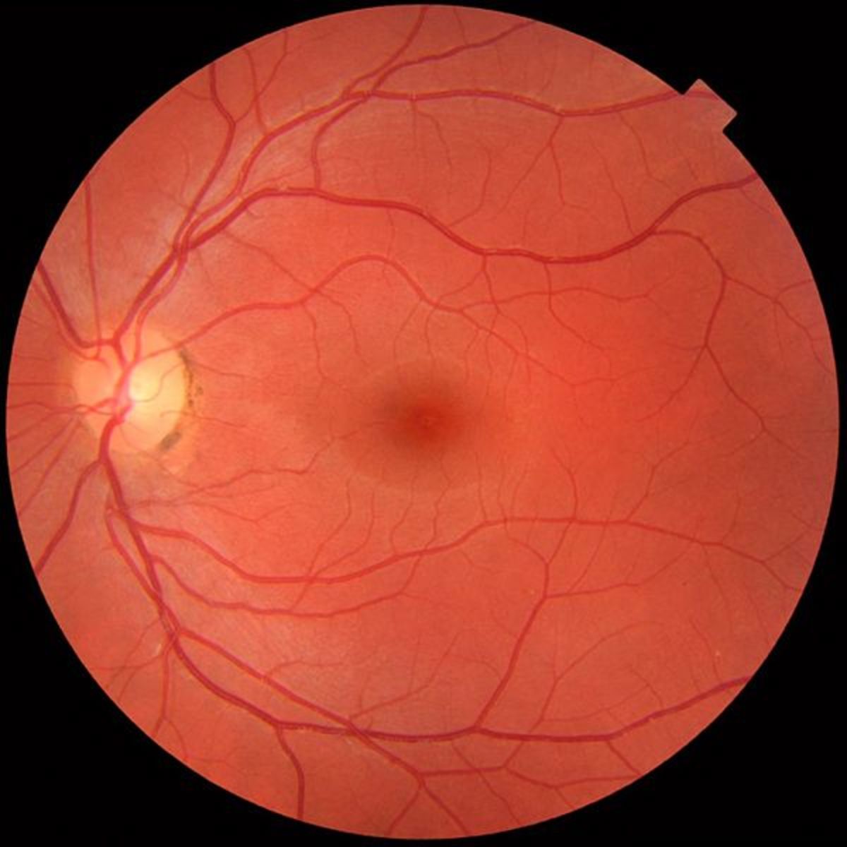 Definition of Retina