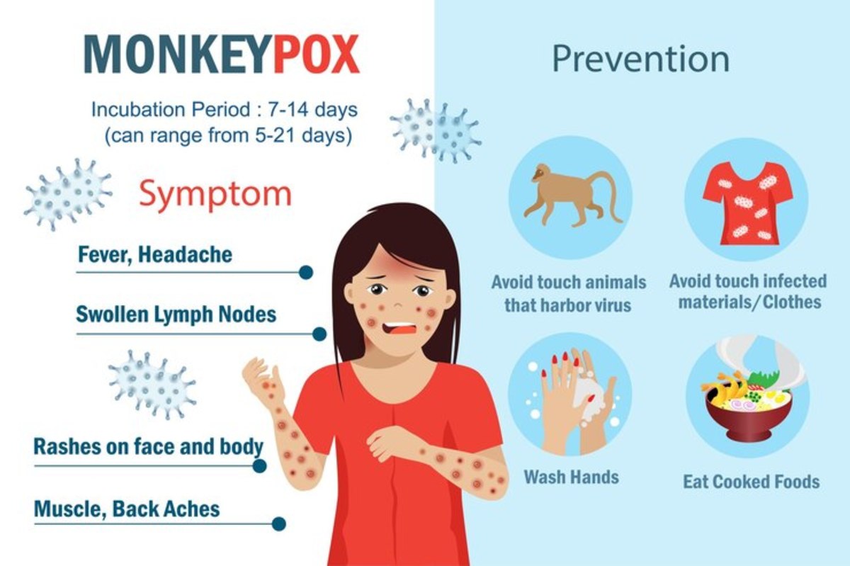 what-is-monkeypox-everything-you-need-to-know