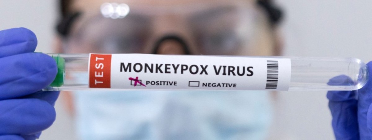 what-is-monkeypox-everything-you-need-to-know