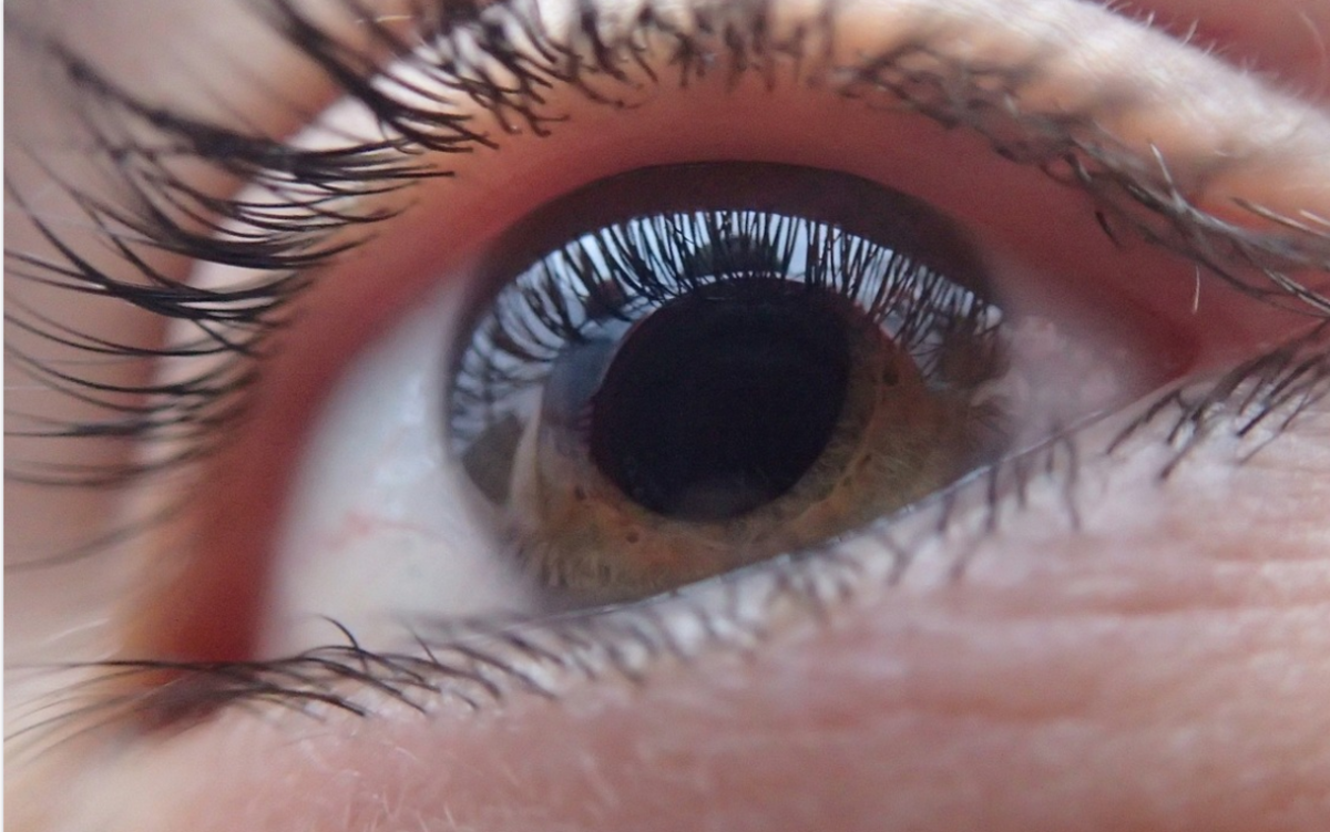 can-you-get-side-effects-from-eye-dilation
