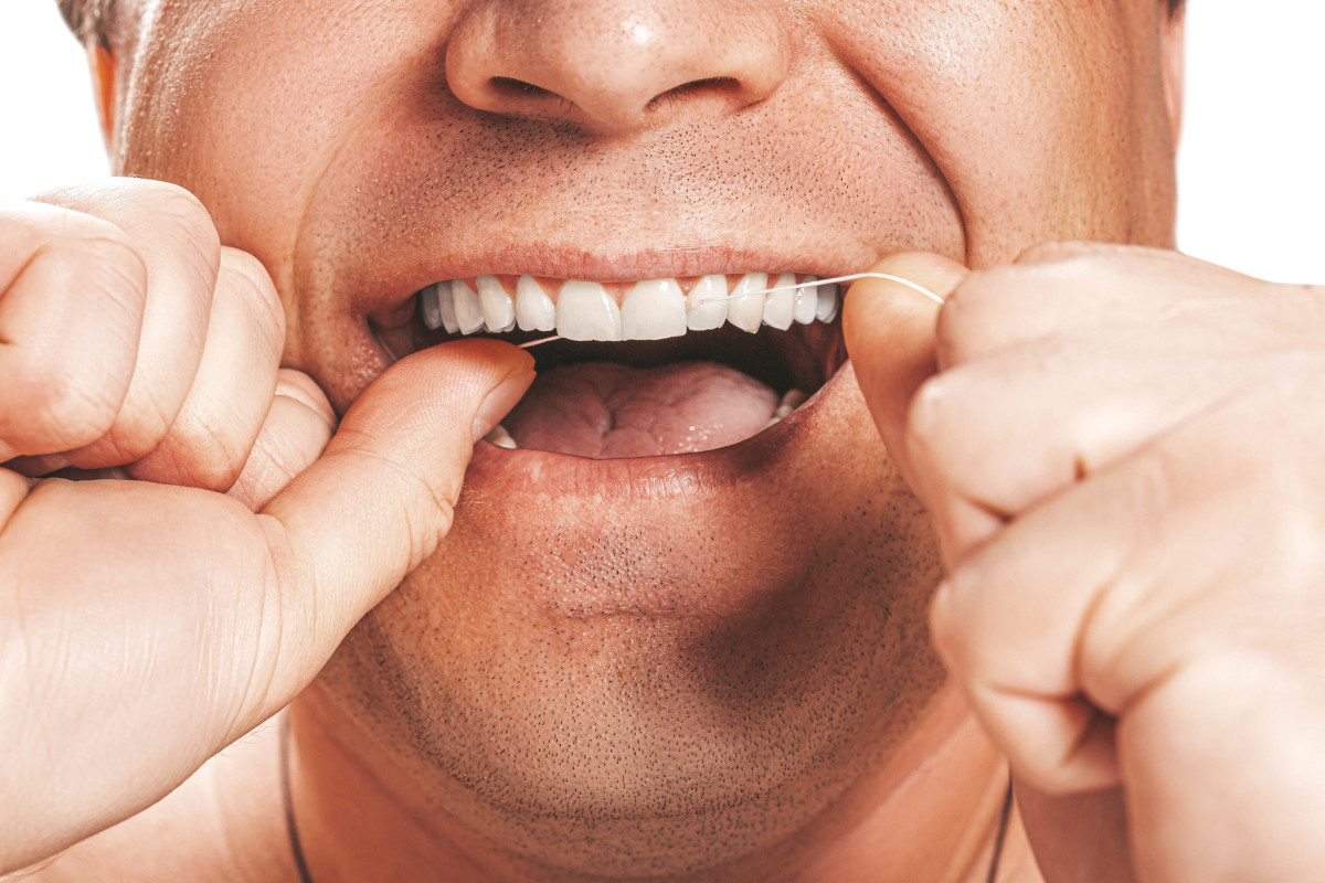 Dental floss can help prevent the development of interproximal cavities