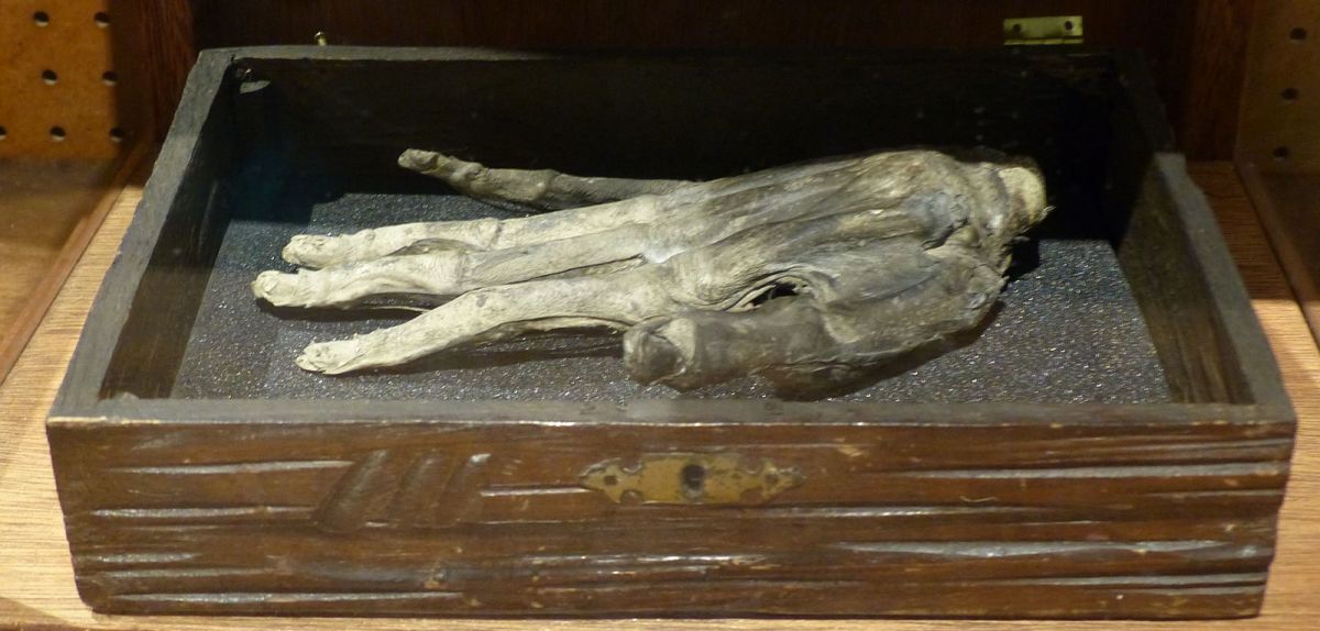A hand of glory discovered in Danby, England, in the early 20th century