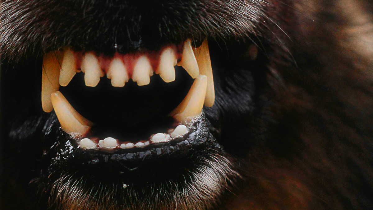 10 Dangerous Dog Breeds: U.S. Dog Attacks and Bite Statistics