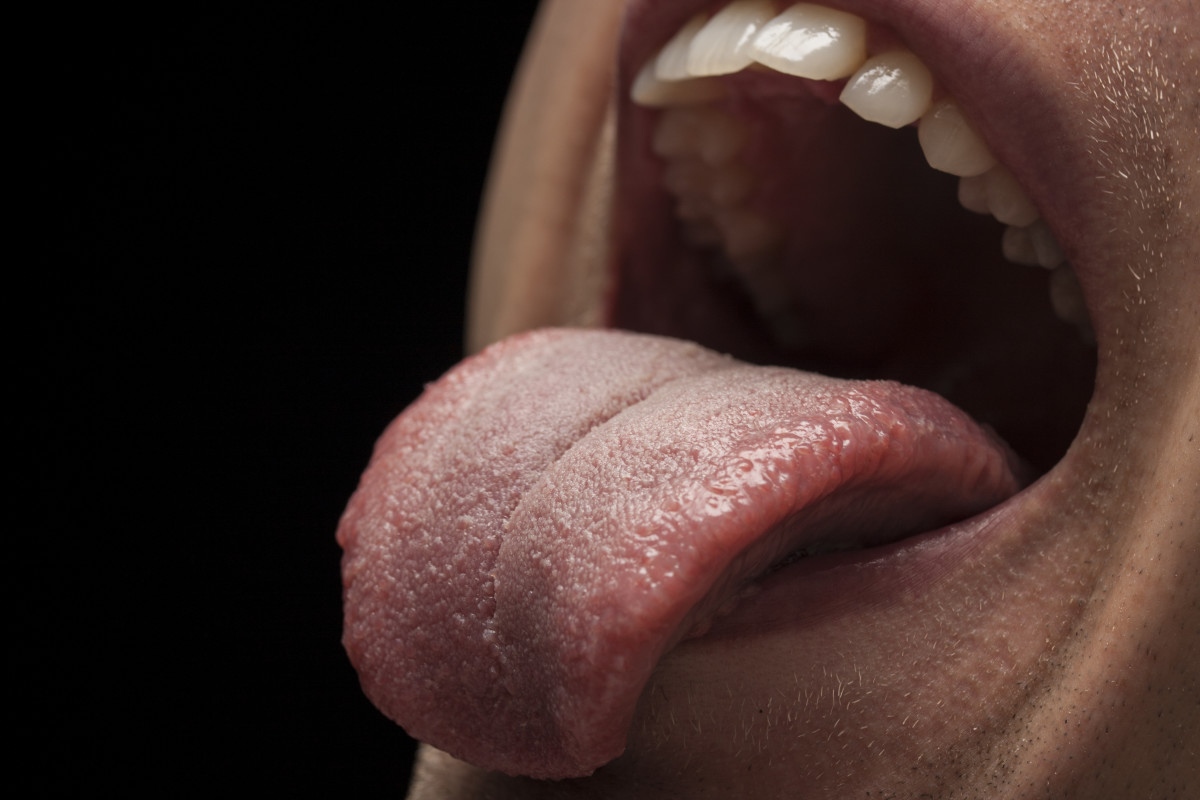 9 Methods for How to Battle Oral Thrush
